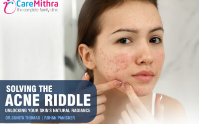 Solving the Acne Riddle: Unlocking Your Skin’s Natural Radiance